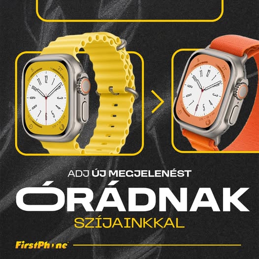💫 Hozzád melyik Apple Watch szíj illik? ⌚